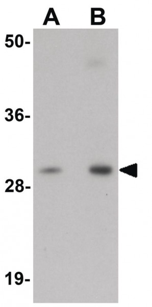 Anti-NSMCE2 / NSE2
