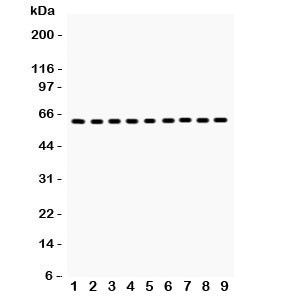 Anti-HSP60