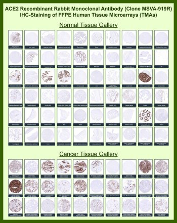 Anti-ACE2 / Angiotensin-converting enzyme 2, clone MSVA-919R