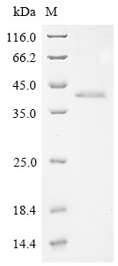 Adhesion G-protein coupled receptor G6 (ADGRG6), partial, human, recombinant