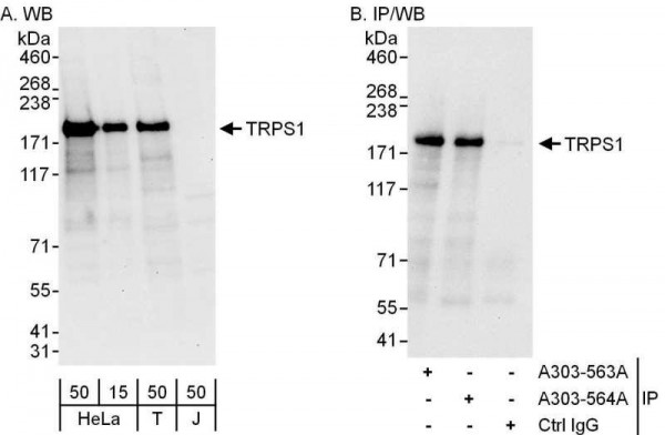 Anti-TRPS1