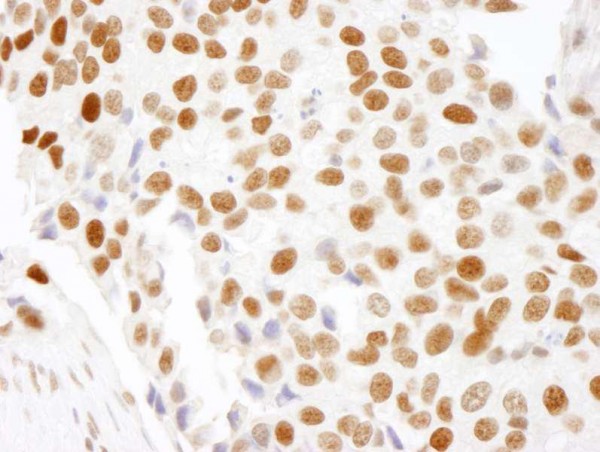 Anti-HMGN1 (IHC)