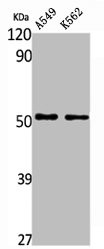 Anti-ALDH3A1