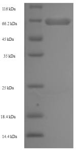AP-2 complex subunit mu (AP2M1), human, recombinant