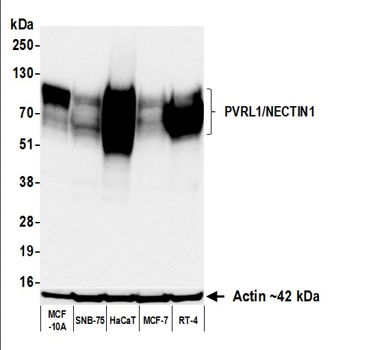 Anti-PVRL1/NECTIN1 Recombinant Monoclonal