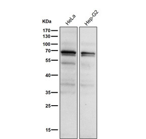 Anti-phospho-PKC alpha (Thr497) / Protein kinase C alpha, clone 32P00