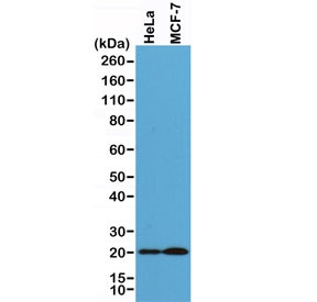 Anti-Smac / Diablo, clone RM271 (recombinant antibody)