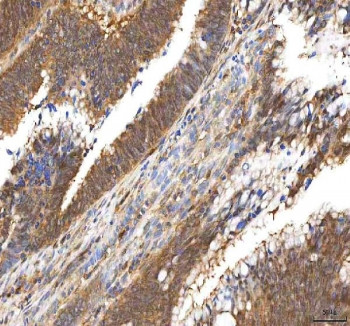 Anti-Pyridoxal kinase / PDXK
