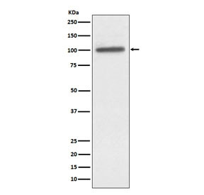 Anti-ACTN4 / Alpha Actinin 4, clone ACIO-1