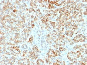 Anti-Frataxin (Marker of Friedreich Ataxia) Monoclonal Antibody (Clone: FXN/2124)