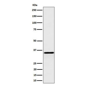 Anti-Pyrophosphatase 1 / PPA1 / Inorganic pyrophosphatase, clone 29P54
