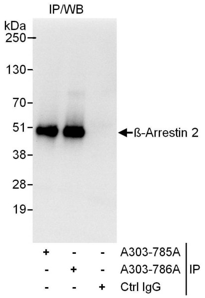 Anti-Beta-Arrestin 2