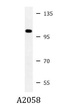 Anti-CEP112 / CCDC46