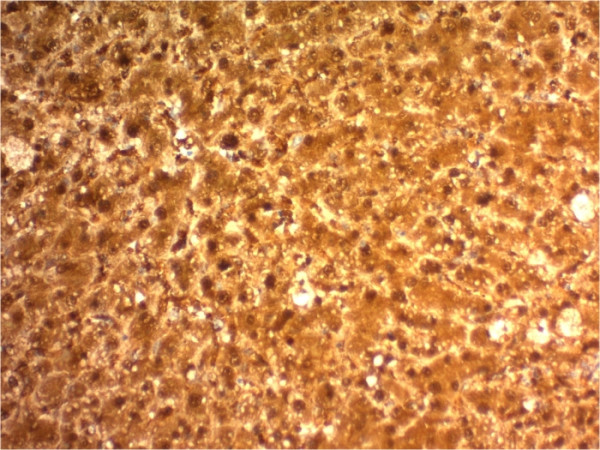 Anti-Arginase1 (Hepatocellular Carcinoma Marker), clone ARG1/1126