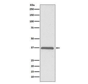 Anti-ERCC1, clone AOFA-5
