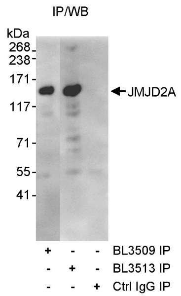 Anti-JMJD2A