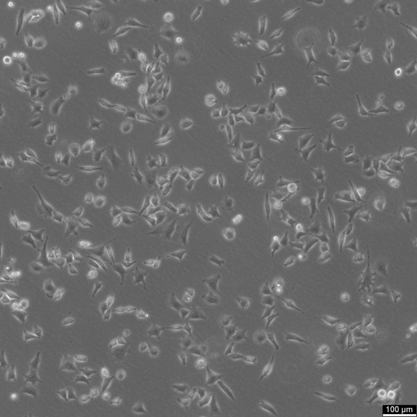 SK-UT-1 Cells