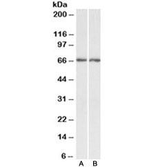 Anti-Acetylcholinesterase