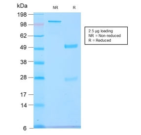 Anti-GnRH Receptor / LHCG Receptor, clone GNRHR/2982R