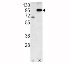 Anti-Amyloid beta