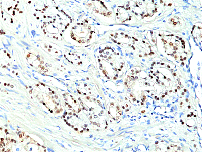 Anti-Nkx3.1 (human), Rabbit Monoclonal (RM430)
