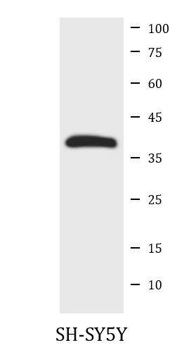 Anti-NADH2 / MT-ND2