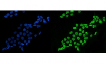 Anti-SF1 / Splicing factor 1