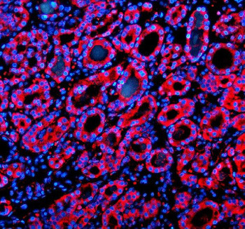 Anti-SIL1 / Nucleotide exchange factor SIL1 / BiP-associated protein