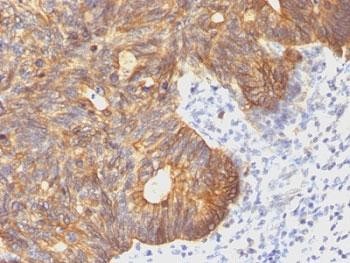 Anti-Cytokeratin 8, clone C-43