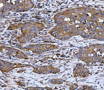 Anti-WDR1 / WD repeat-containing protein 1, clone 5C11C8
