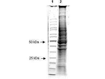 Hep2 Whole Cell Lysate, 1.0 mg/ml by BCA assay, in 1X SDS-PAGE Sample Buffer