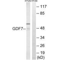 Anti-GDF7