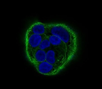 Anti-Cytokeratin 18 / KRT18, clone HB-11