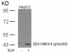 Anti-phospho-SEK1/MKK4 (Ser80)
