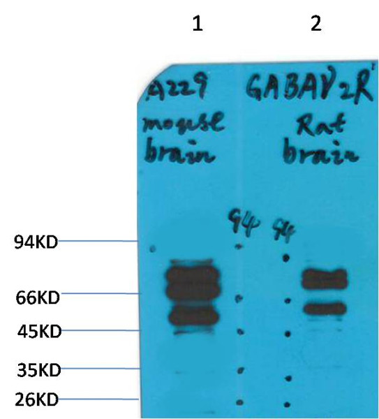 Anti-GABA A Receptor gamma2