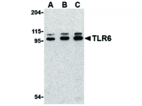 Anti-TLR6