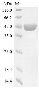 Apolipoprotein A-V (APOA5), partial, human, recombinant