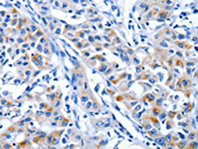 Anti-IGF2BP1