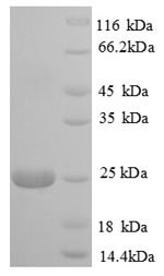 Polymeric immunoglobulin receptor (PIGR), partial, bovine, recombinant
