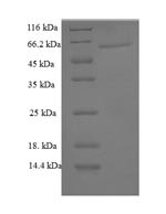 Galectin-6 (Lgals6), mouse, recombinant