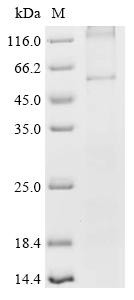 Frizzled-2 (FZD2), recombinant human