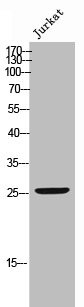 Anti-Phospho-BCL2 (S70)