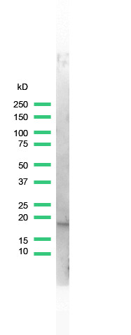 Anti-Stathmin, clone SP49