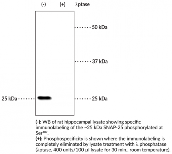 Anti-phospho-SNAP-25 (Ser187)