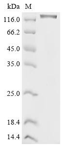 Vascular endothelial growth factor receptor 2 (KDR), partial, recombinant human