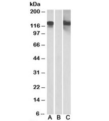 Anti-CDH11