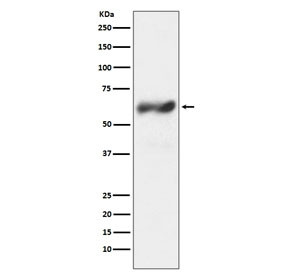 Anti-c-Fos, clone IIO-6