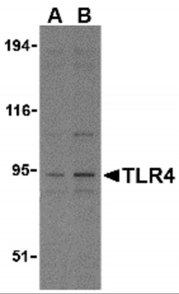 Anti-TLR4