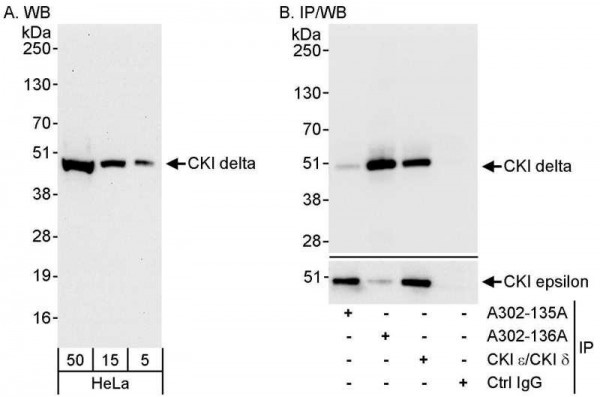 Anti-CKI delta