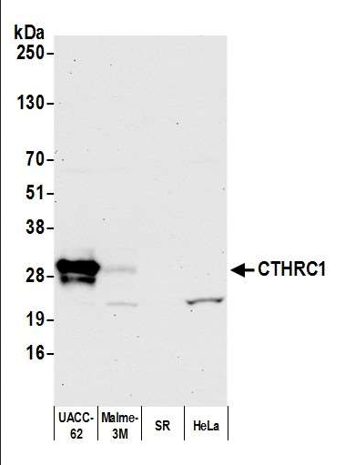 Anti-CTHRC1